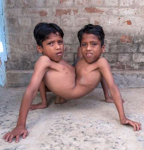 Shivanath e Shivram Sahu são gêmeos siameses. Desde seu nascimento, são adorados como se fossem encarnações divinas no pequeno vilarejo onde nasceram, na Índia. Hoje com 12 anos, os meninos nem pensam em se separar.