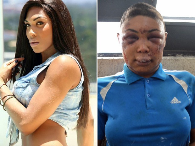 Travesti fica desfigurada após prisão; Defensoria diz haver indício de tortura (Foto: Foto: Reprodução/Facebook; Divulgação/Defensoria Pública)