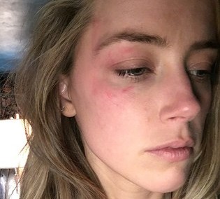 Ator Johnny Depp é acusado pela mulher de cometer violência doméstica