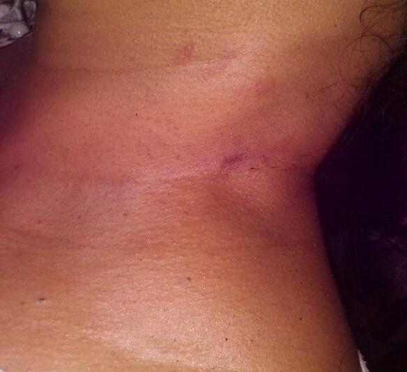  Mulher de 35 anos é agredida pelo namorado em Capinópolis