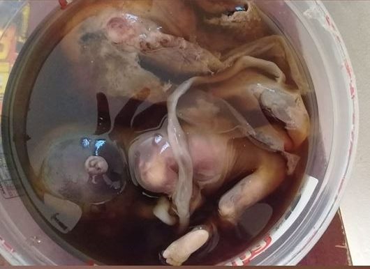  Hospital de Ituiutaba entrega feto abortado para mãe levar para casa em uma vasilha de paçoca