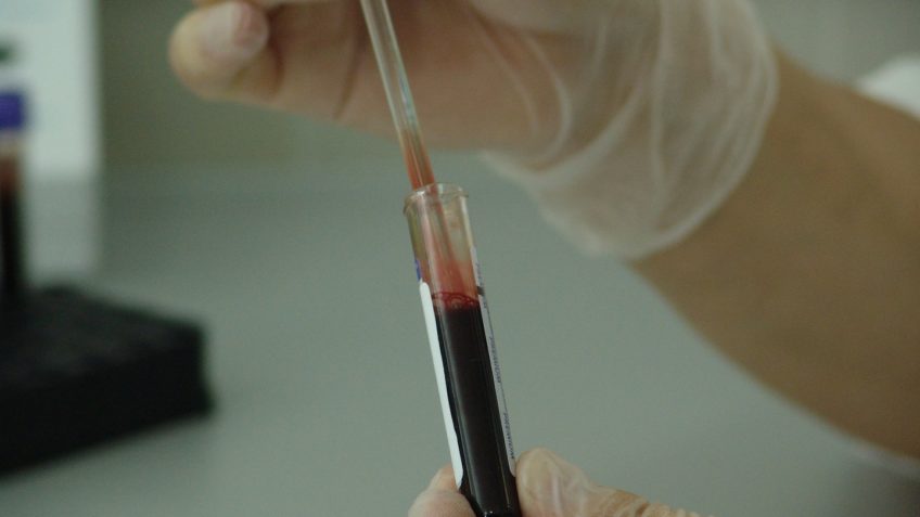 A OMS declarou emergência global para a varíola dos macacos em 23 de julho; na foto, tubo de sangue ...